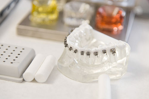 Zahnbehandlungen